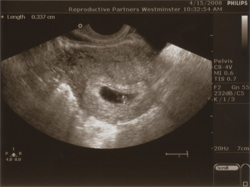 Scan from Tuesday morning